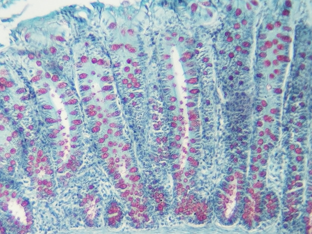 Simple Columnar Epithelium Slides - Simple Columnar Epithelium 05 100X
